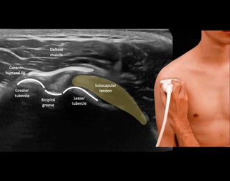 /Content/ServiceImages/biceps-holder (1) (3).jpg